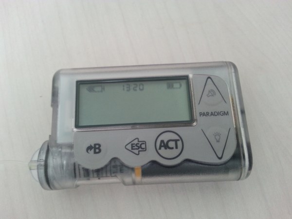 paradigm insulin pump tattoo