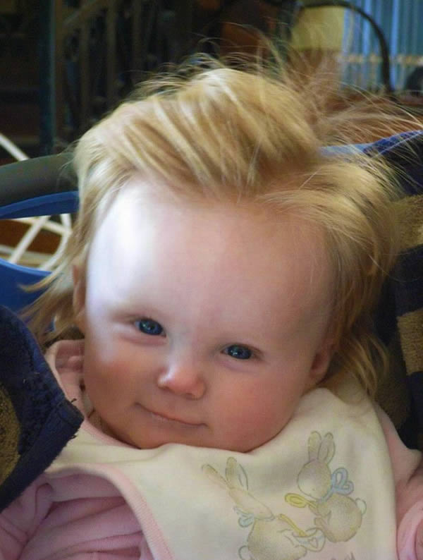 10 Babies Born With The Craziest Hairstyles Oddee