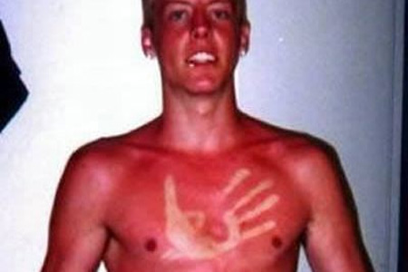 15 Worst Tan Disasters - bad tanning, tan fail - Oddee